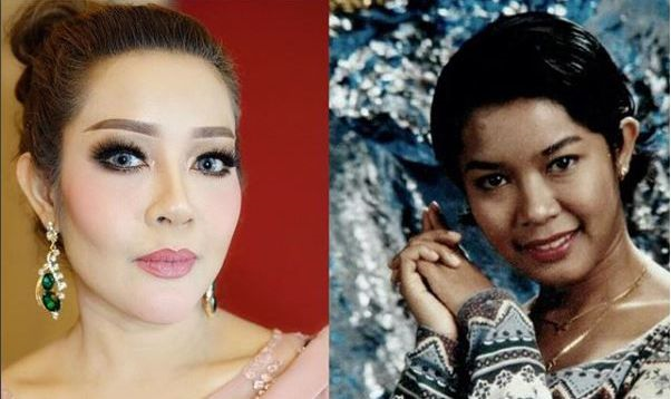 Perbezaan Wajah Ifa Raziah Dulu Dan Kini..Kenapa Lain Sangat Ni?