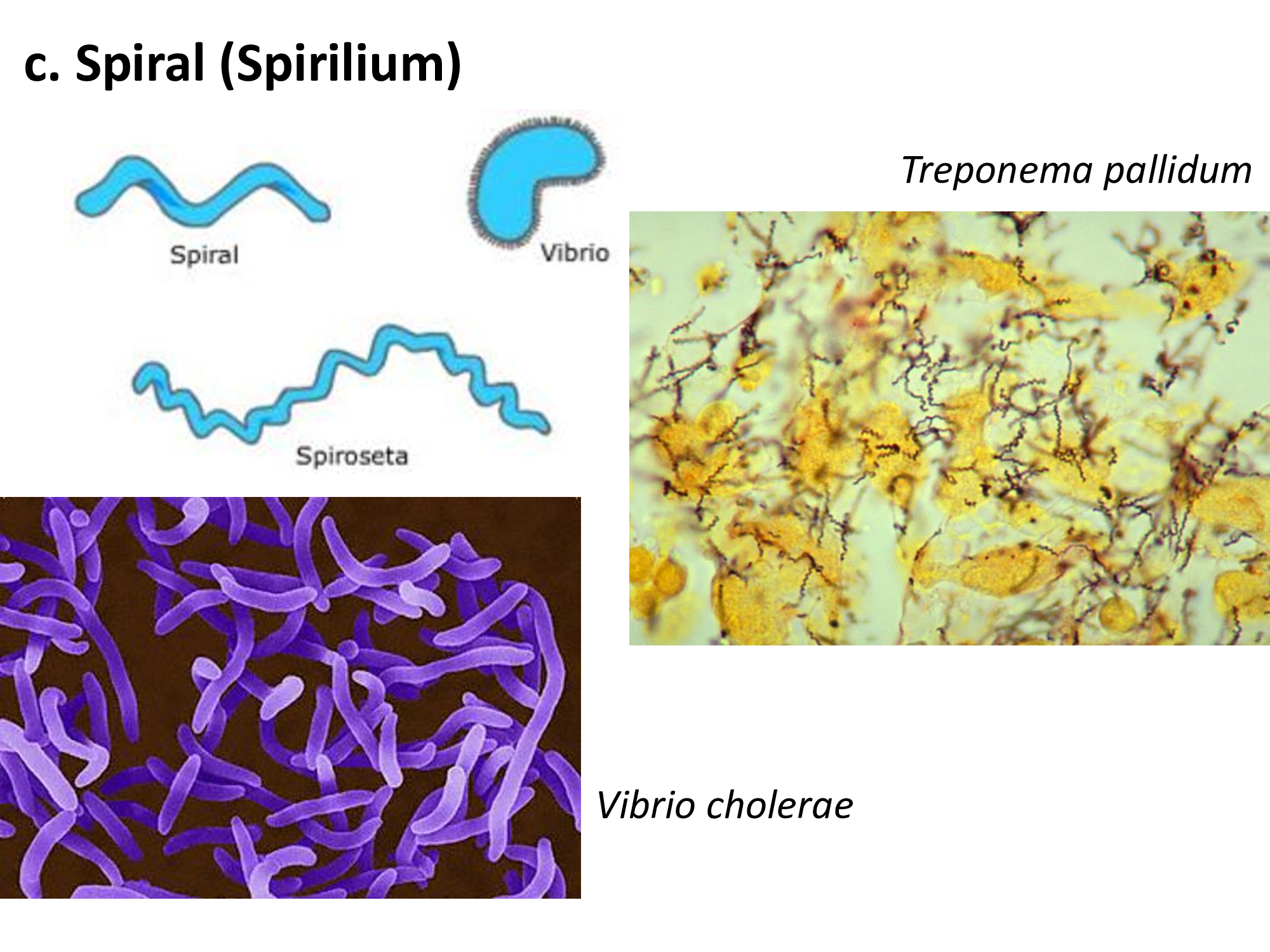Treponema pallidum отрицательный. Трепонемы микробиология. Трепонемы расположение клеток.