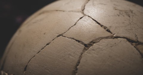 Synchrotron X-ray sheds light on some of the world's oldest dinosaur