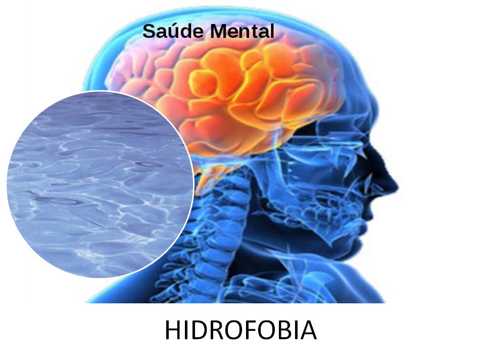 Porque A Raiva E Conhecida Como Hidrofobia