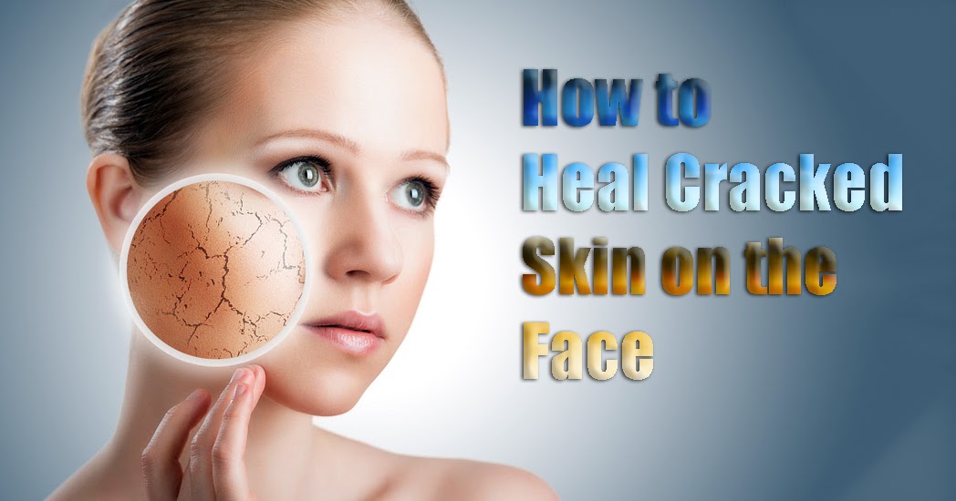 How to Heal Cracked Skin on the Face Natural Remedies And Treatment