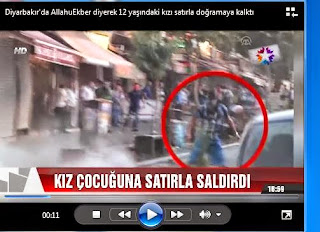 Diyarbakır'ın Sur ilçesini karıştıran küçük çocuğa yapılan satırlı saldırı