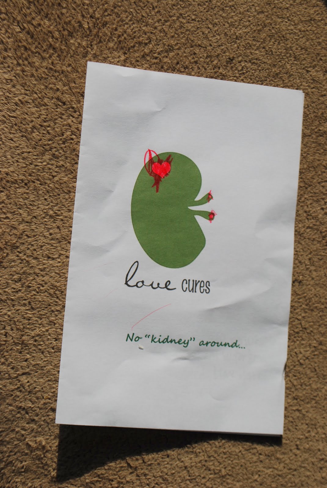 Charity's Chatter 1 year kidney transplant anniversary