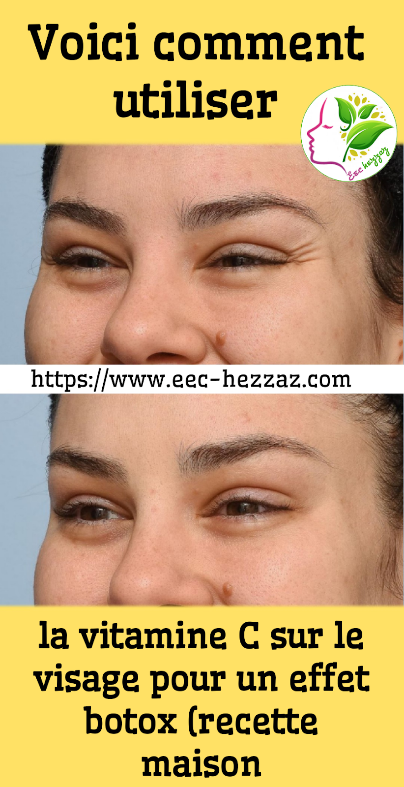 Voici comment utiliser la vitamine C sur le visage pour un effet botox (recette maison)