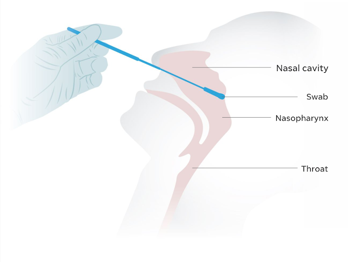 Sakitnya Swab Test!