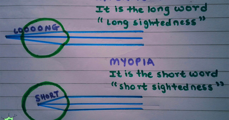 szem myopia és hyperopia)