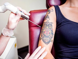 steps of tattooing, how is a tattoo removed, irezumi tattoo