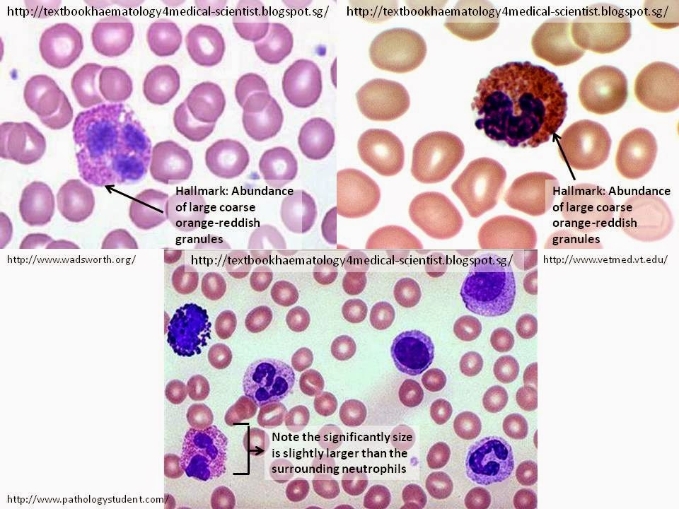 Haematology in a NutShell Eosinophils
