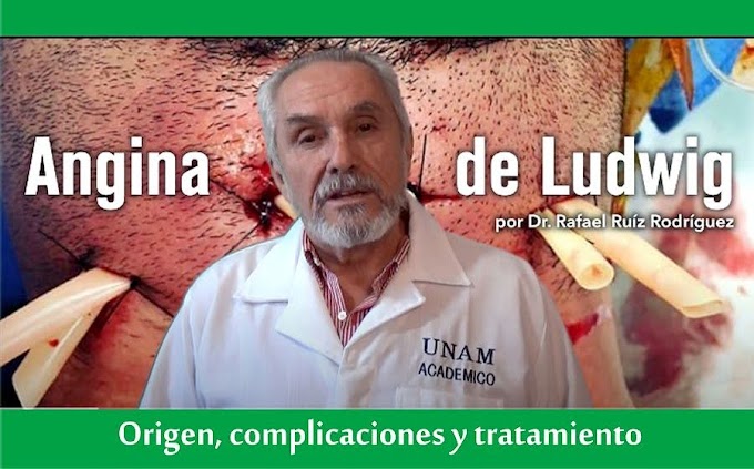 ANGINA DE LUDWIG: Origen, complicaciones y tratamiento - Dr. Rafael Ruíz Rodríguez