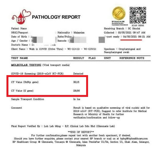 Gene rdrp ct 什么 value 是 武汉病毒所揭示病毒RdRP核苷酸催化循环机制