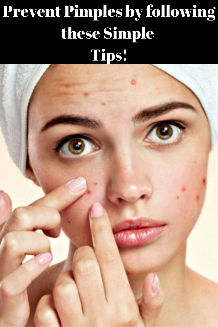 Angie's Lifestyle Tips Prevent Pimples by following these Simple Tips!