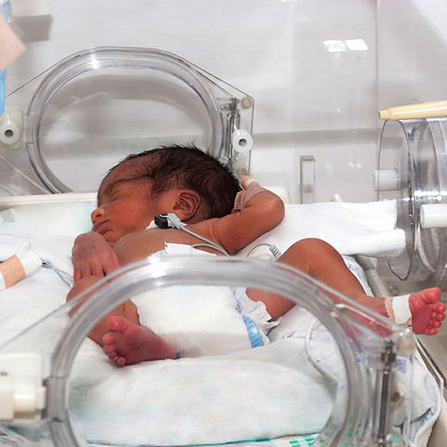 Родился слабый ребенок. Недоношенный ребёнок в инкубаторе. Инкубатор для недоношенных новорожденных. Кювез для недоношенных детей.