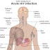 Hiv,Hiv full form, hiv rash, hiv symptoms, signs of hiv, hiv symptoms in men, triumeq, hiv symptoms in women, descovy, early symptoms of hiv, hiv positive, hiv virus, hiv symptoms rash, ccr5, signs and symptoms of hiv, hiv infection, human immunodeficiency virus, hiv meds..