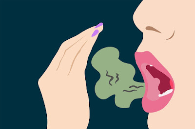 Types of bad breath smells.