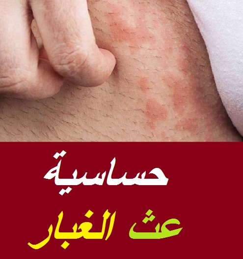 العث ومعلومات مهمة من مركز الأبحاث الألماني