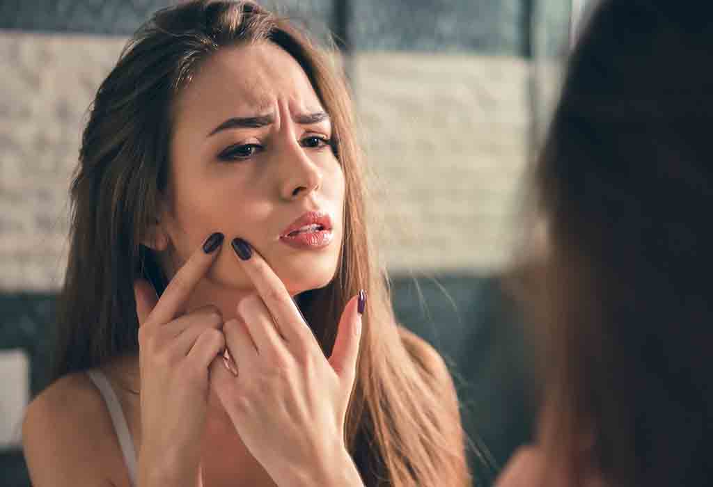Pimples on Face Removal Tips in Marathi