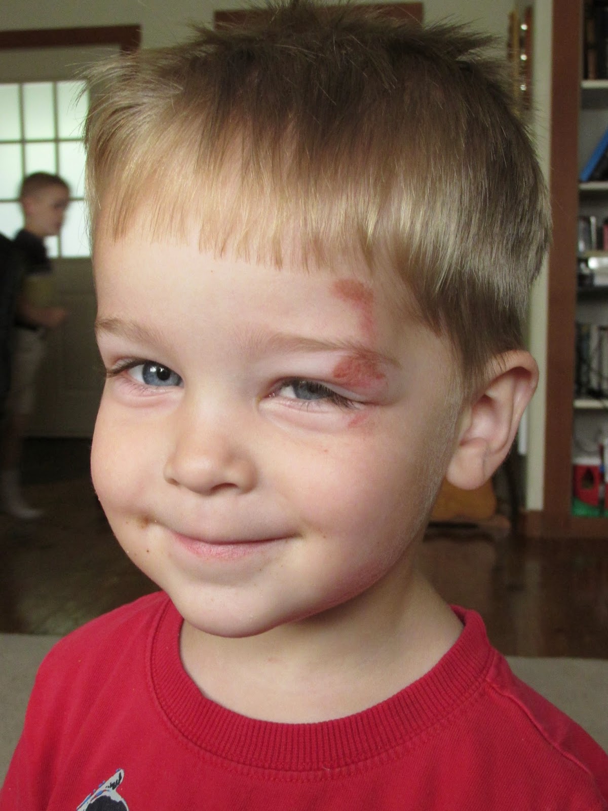 The Mennagerie Road Rash