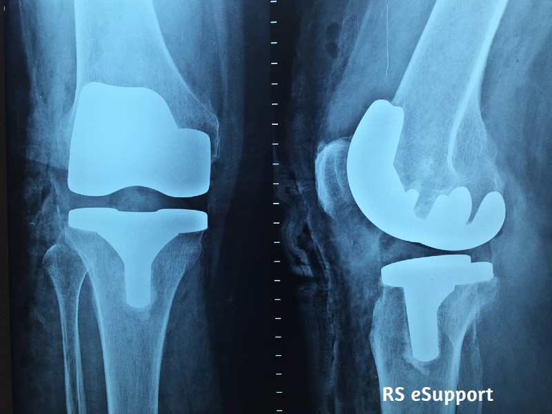 Cmc Vellore Orthopaedic Doctors List