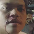 Remaja Jadi Korban Penembakan di Bandung, ‘Teman Saya Disandera, Kepala Dipukul sampai Berdarah’