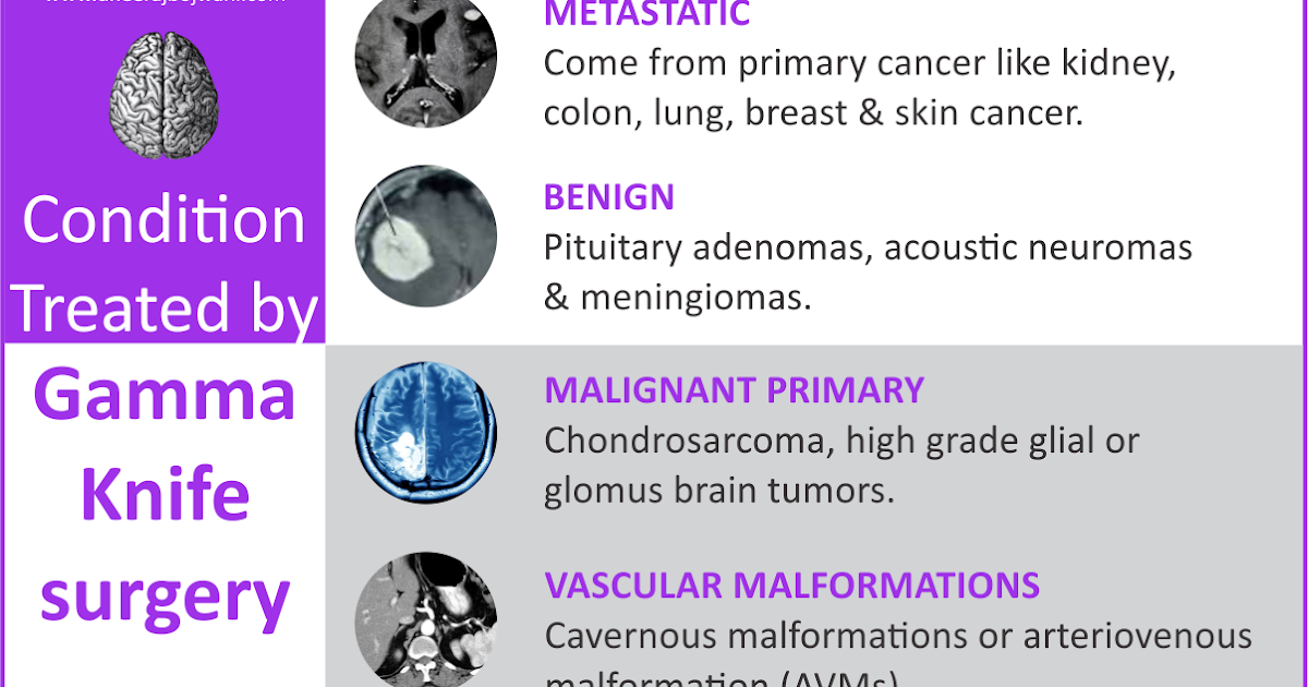 Advance Gamma Knife Radiosurgery at low Cost In India