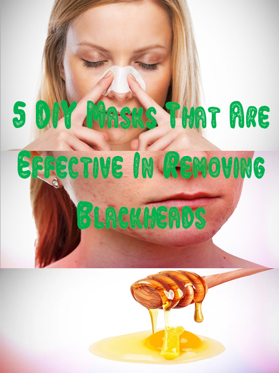 5 DIY Masks That Are Effective In Removing Blackheads beauty2natural