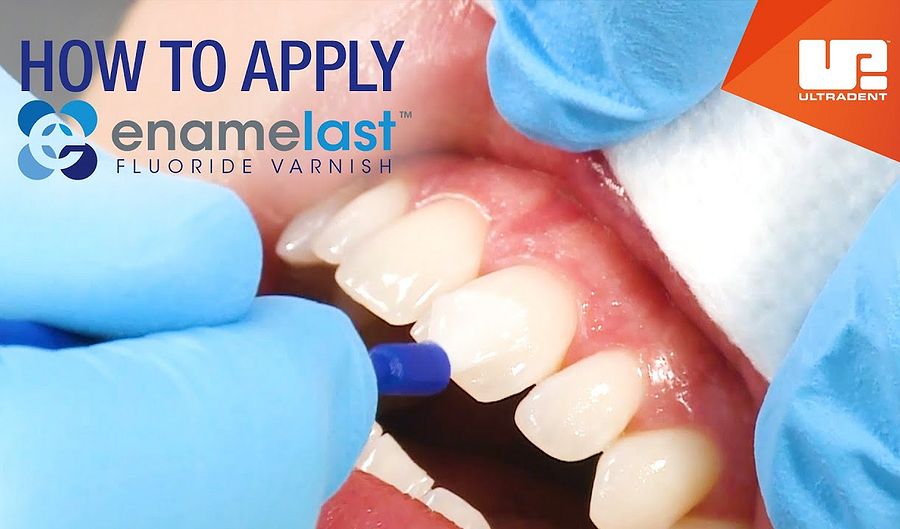 ENAMELAST Fluoride Varnish Learn how to apply step by step