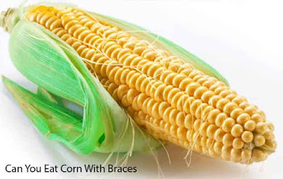 Can You Eat Corn With Braces