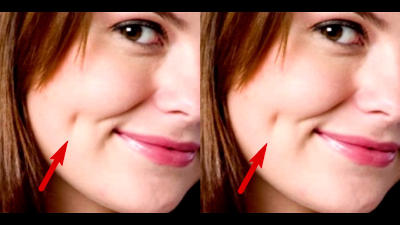 Here Is The Meaning Of The Dimples On The Cheeks