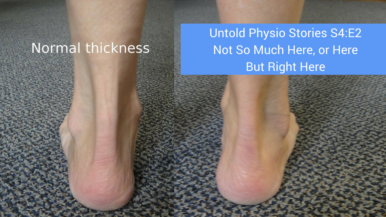 Untold Physio Stories S4:E2 - Not Too Much Here, or Here, But Right ...
