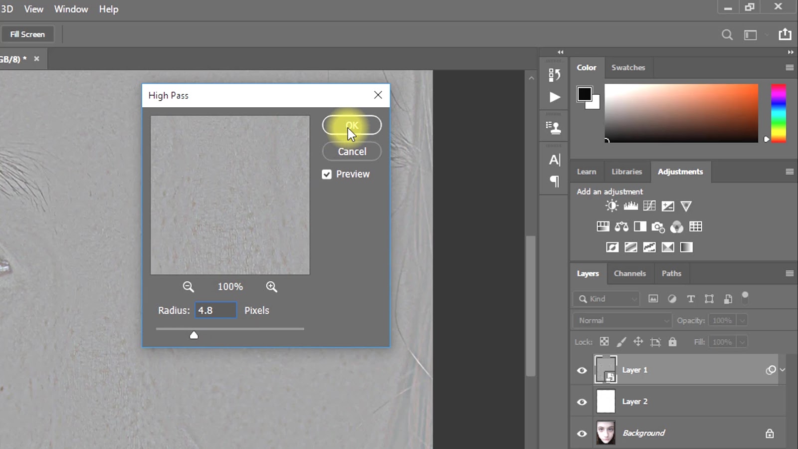 How to Remove Eye bags and Eye Dark Circle in