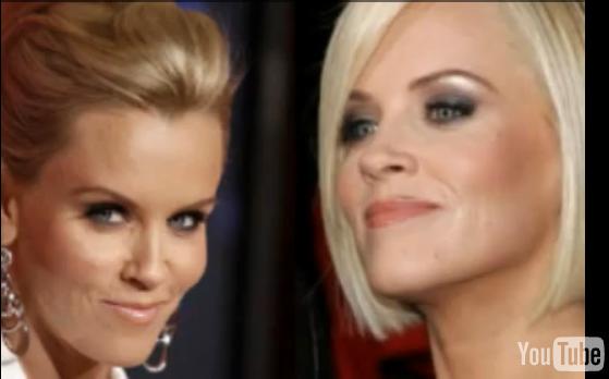 Information Hub: Celebrities before and after Botox Treatment - Part 1