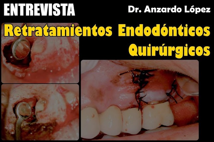 ENTREVISTA: Retratamientos Endodónticos Quirúrgicos - Dr. Anzardo López