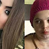 "Nunca fiz mal a ninguém" diz jovem que teve 45% do corpo queimado por uma desconhecida