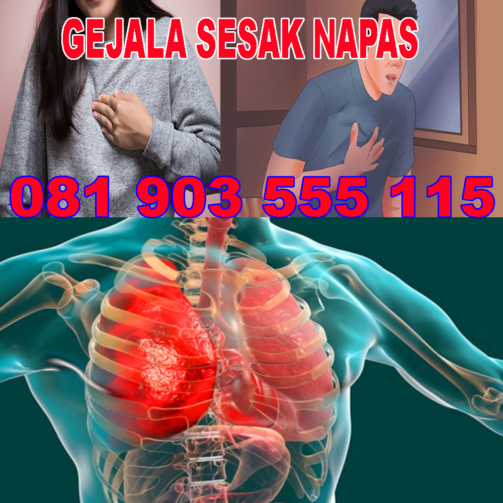 Obat Sesak Napas Karena Asma