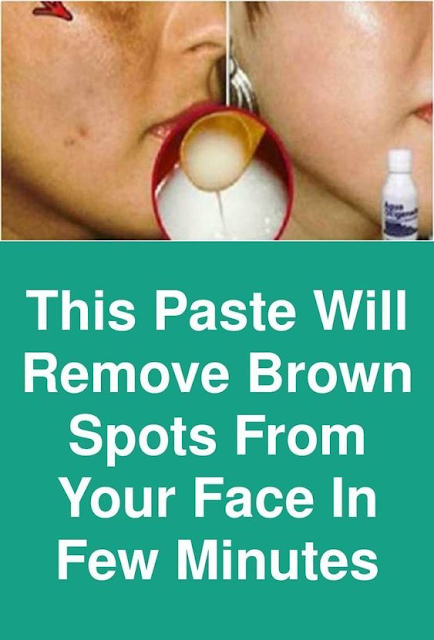 This Paste Will Remove Brown Spots From Your Face In Few Minutes