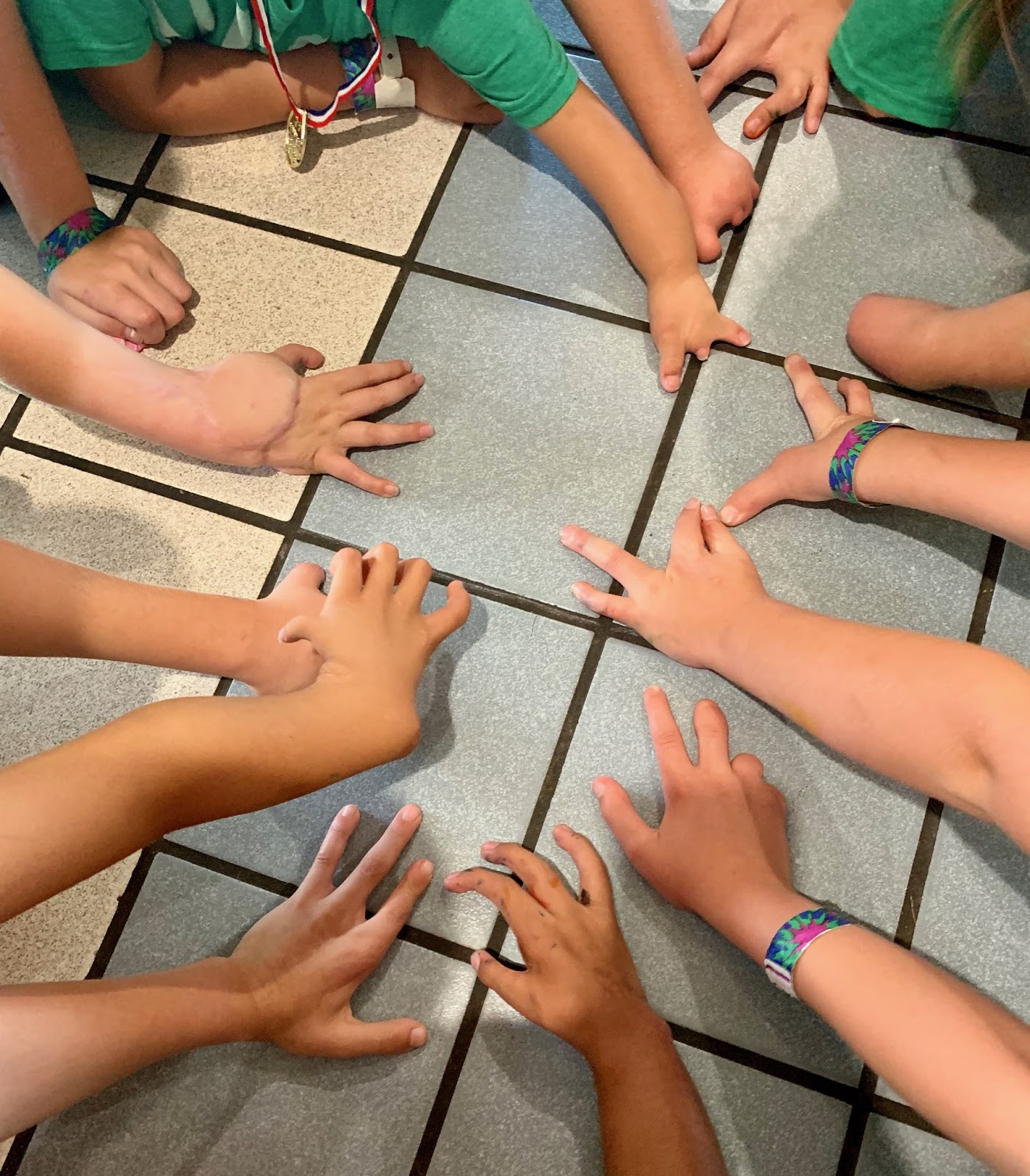 Hand Camp 2019 St. Louis Shriners Hospital Congenital Hand and Arm