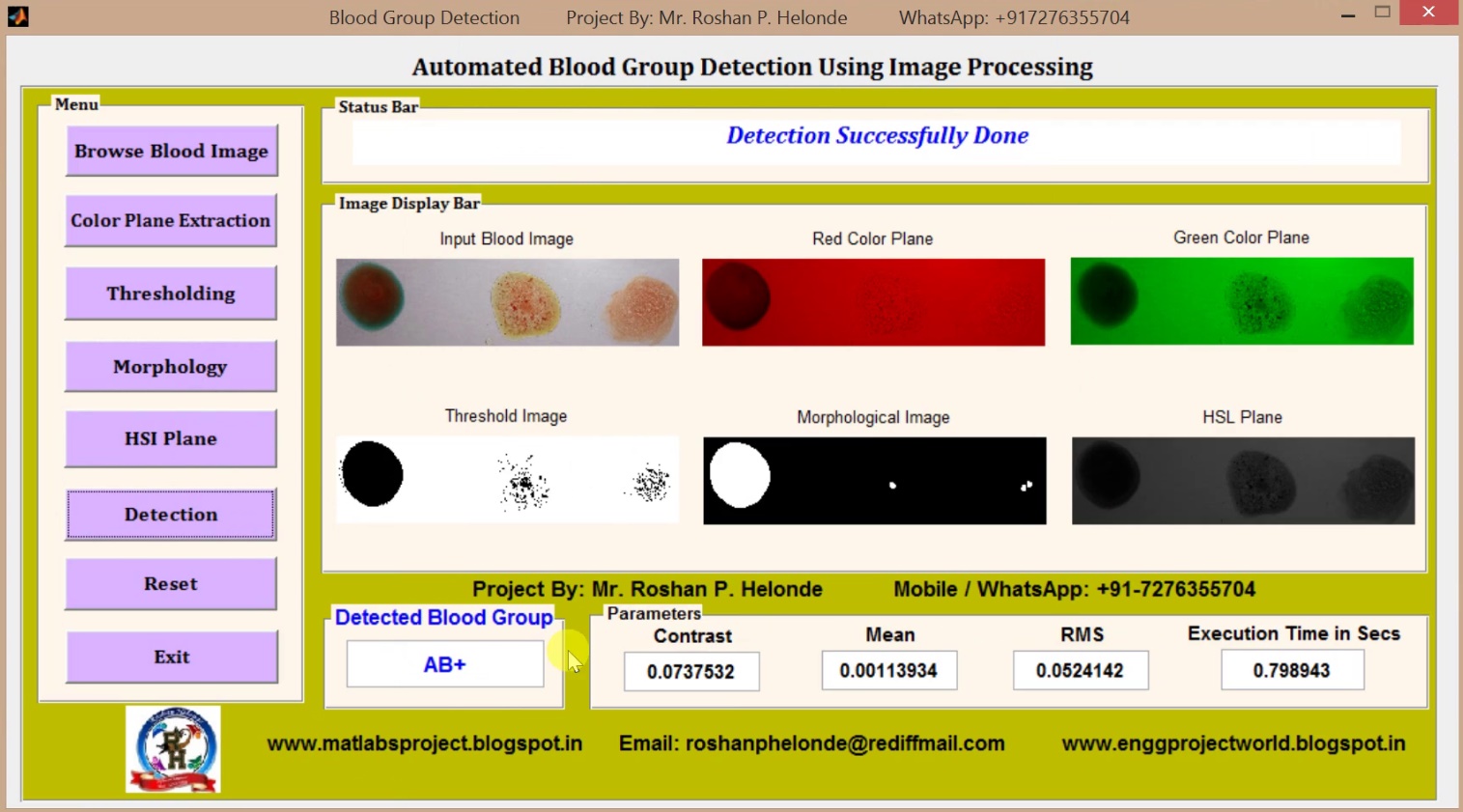 Blood Group Detection Using Image Processing Matlab Source Code || IEEE ...
