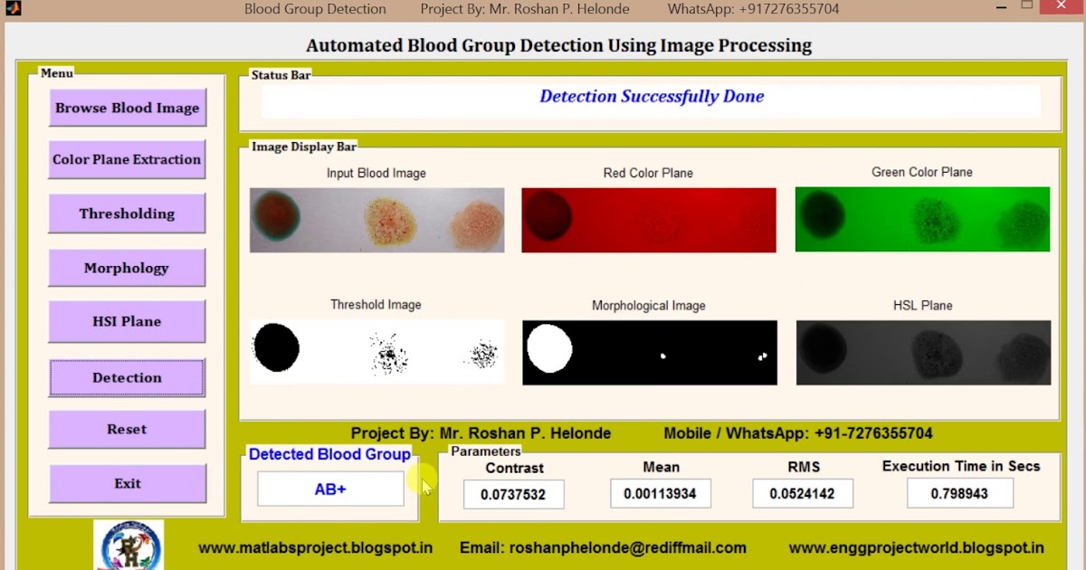 Blood Group Detection Using Image Processing Matlab Source Code || IEEE ...