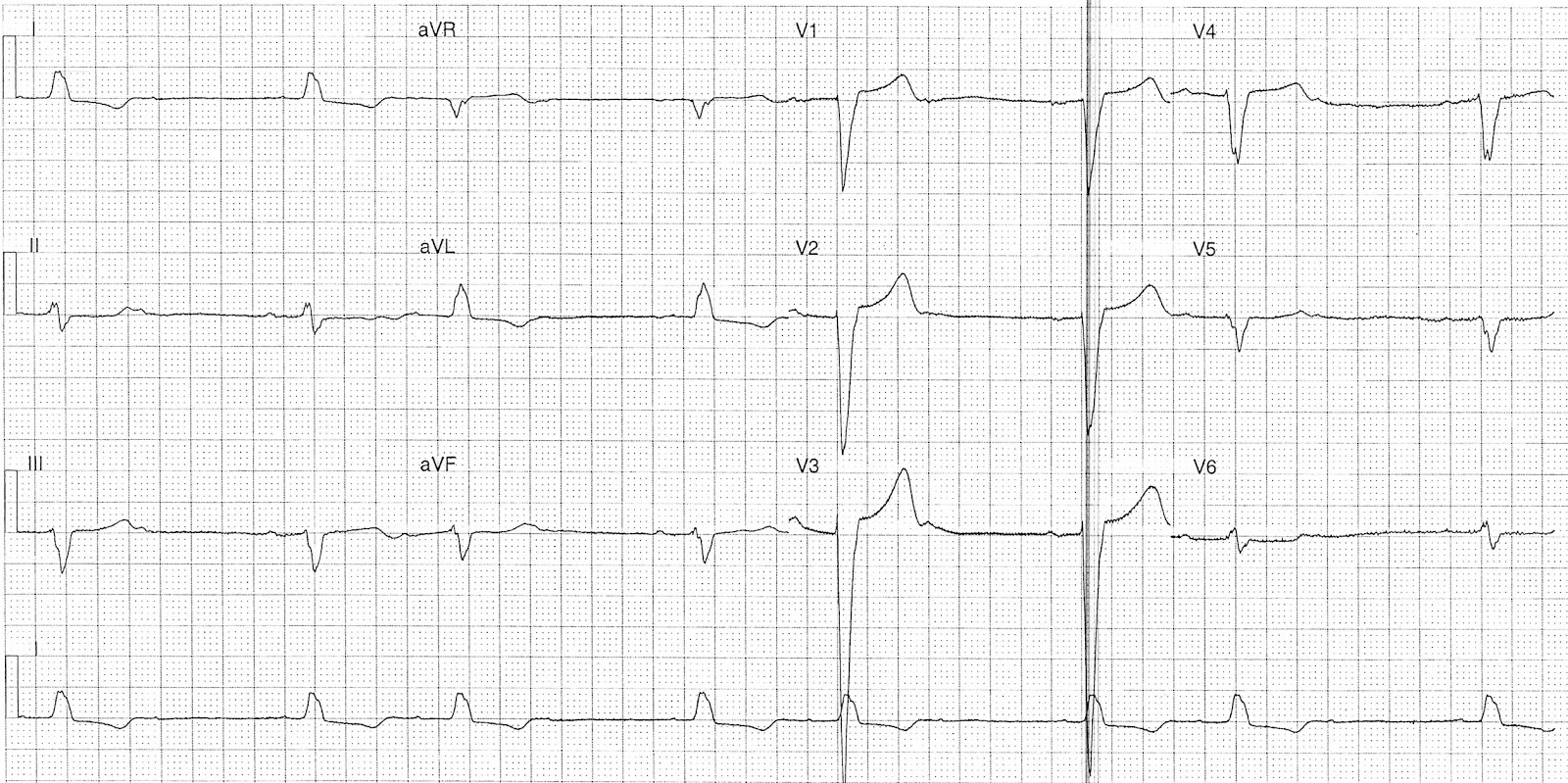 cloudtag ecg cloudtag ecg