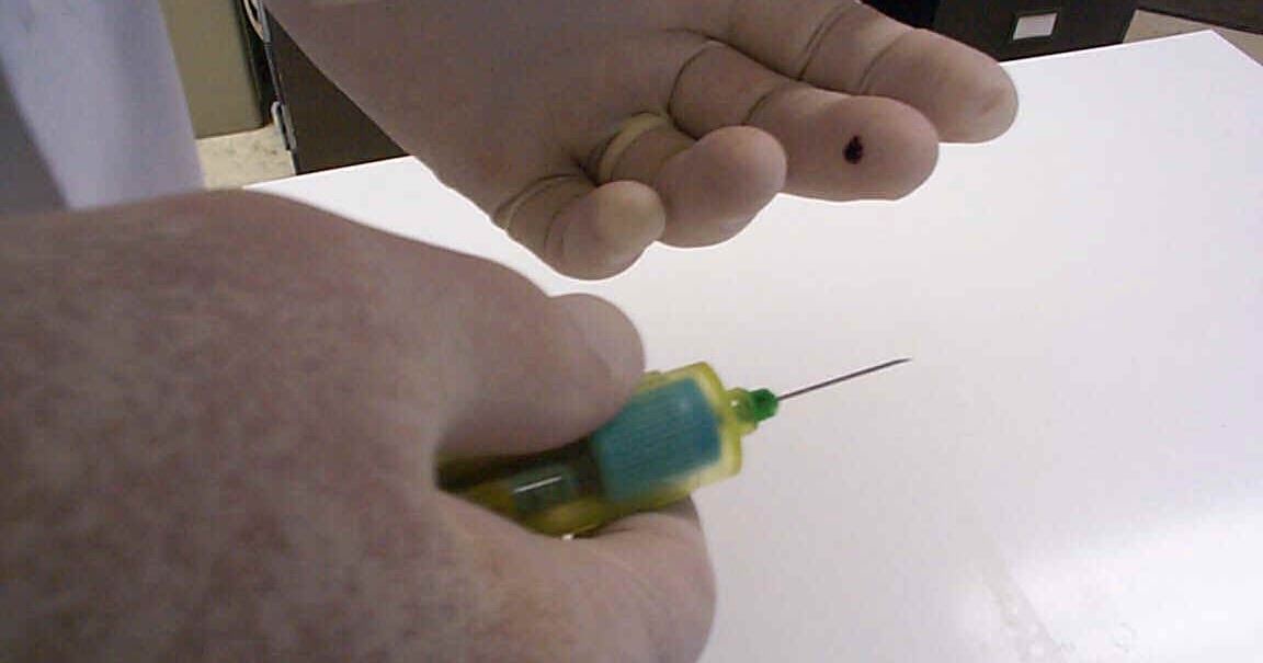 LABORATORY ACCIDENTS