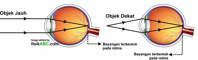 proses pembentukan bayangan pada mata normal (emetropi) saat melihat benda