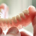 Răng giả tháo lắp nhựa dẻo hiệu quả nhất cho ai?