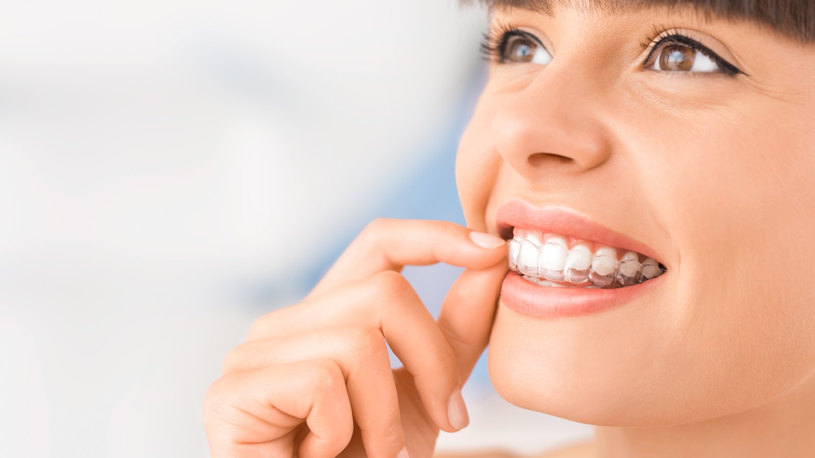 A General Procedure To Treat Underbite By Invisalign Method