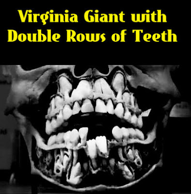 www.nephilimgiants.net : Giant Human with Double Rows of Teeth Found on