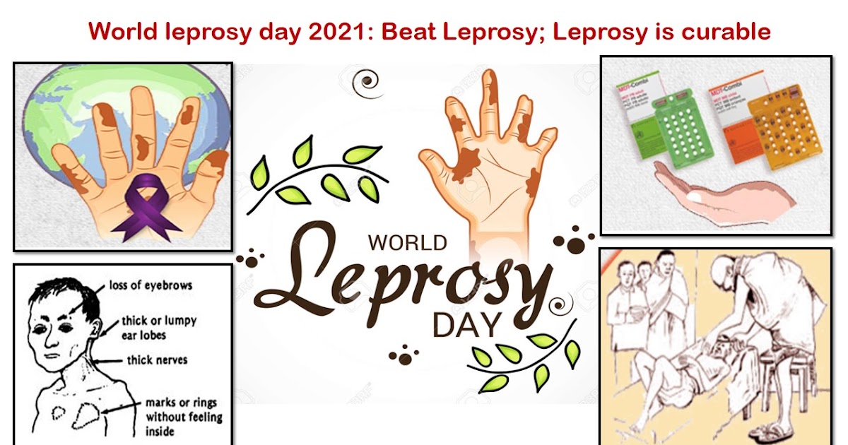 The Family physician World leprosy day 2021 Beat Leprosy; Leprosy is