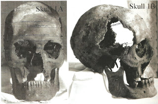 Joseph Smith's Skull