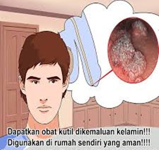 Cara menghilangkan kutil kelamin dengan cuka, gambar kutil di kelamin, kutil kelamin pria, obat penghilang gatal kutil kelamin, salep penghilang kutil di kelamin, obat menyembuhkan kutil kelamin atau kutil di kemaluan, obat tradisional kutil kelamin atau kutil di kemaluan, cara mengobati kutil kelamin atau kutil di kemaluan tradisional, menghilangkan kutil di kelamin, obat kutil kelamin atau kutil di kemaluan ibu hamil, obat kutil kelamin atau kutil di kemaluan wanita