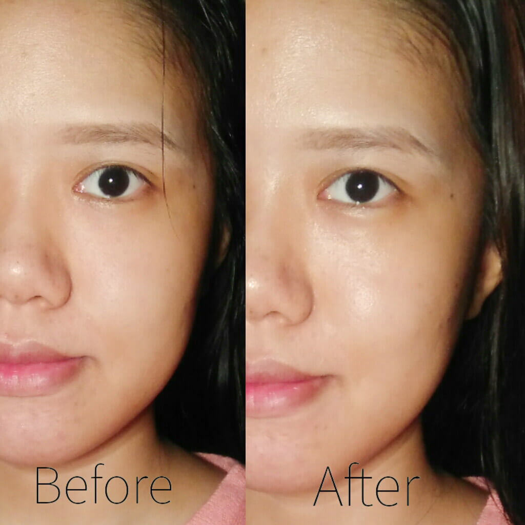 testi serum scarlett