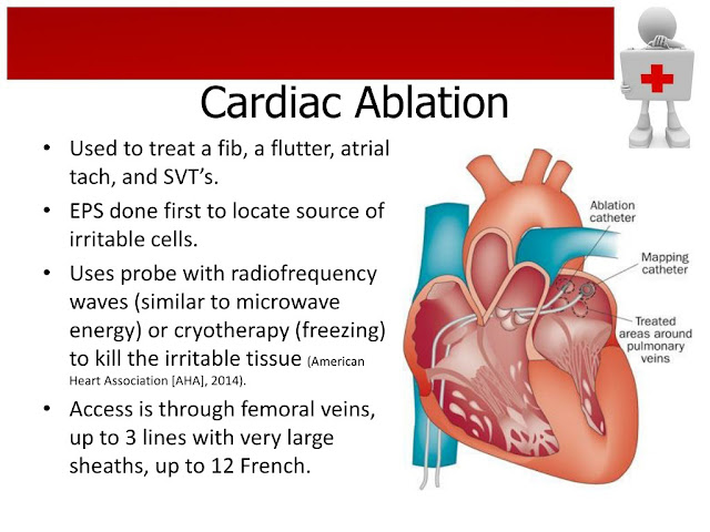 travel after heart ablation
