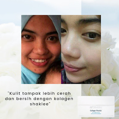 Promosi Collagen Shaklee 2019 Jualan Kilat